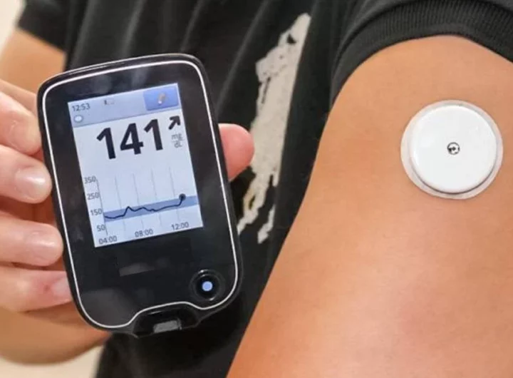 Continuous Glucose Monitoring Systems